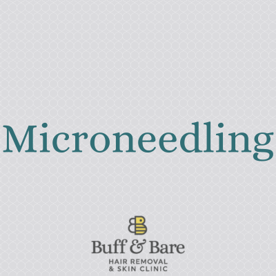Microneedling. Microneedling with radio frequency treatment from Buff & Bare St Albans