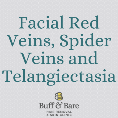 spider veins. Red and spider vein treatment from Buff & Bare in St Albans