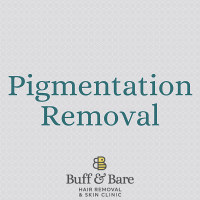 Pigmentation Removal. Laser services from Buff & Bare